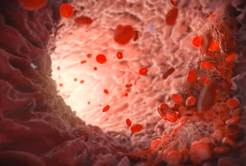 8680-hxsrwwr1995265___gif.jpg